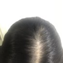 [탈모일기] 자올 200일 자체 체험단