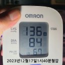 ‘젊은 뇌졸중’ 발병 나이 43.6세에서 42.9세로 낮아지는데… 이미지