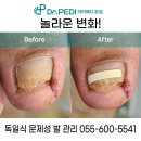 발톱닥터