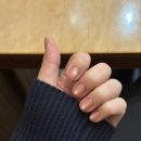 하이피네일