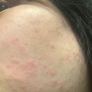 에르샤몽 연세강남의원 이미지