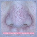 세종의료기 | 세종시아쿠아필 이런 분들이 받으면 오히려 독이 됩니다