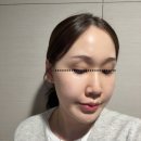 양재동 20-35앞 보도 | 양산에스테틱 에끌라스킨 물광 윤곽관리 효과 후기