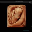 한나여성의원 이미지