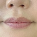 오빛나의원 이미지