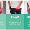 (주)산성헬스케어 네이버블로그