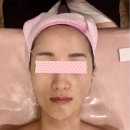 송파 피부관리 ‘올가드림뷰티 삼전역점’에서 메디컬 드림케어 만족 후기