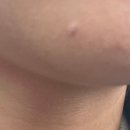 산본노블클래식의원 | 산본 노블클래식의원 점뺀 후기 (비추)