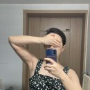 포즈의원 | 결혼전 팔뚝지방흡입 수술한 후기 (피팅의원)