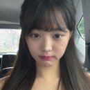 웅이안경 | 매몰쌍수 앞트임 옆트임 후기 및 준비물