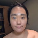 사직동 | 사직동 에스테틱 스웰드 후기 신부관리 추천