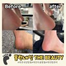 The Beauty | 대전 문제성 발 전문샵 | 괴정동 발관리 각질케어 잘하는곳 "뮬랑네일 the beauty" 방문후기