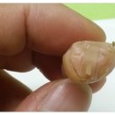 들리미보청기 이미지