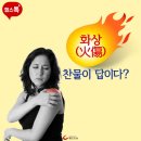 화상, 찬물이 답이다? 이미지