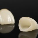 서울순플란트치과의원 이미지