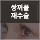 재시아성형외과의원 | 쌍꺼풀 재수술 잘하는 곳 선택의 기준은 'OO'이 중요합니다.