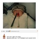 [펌] 새로운 신생아 학대 사건입니다. 이번에는 미숙아라네요;; 이미지