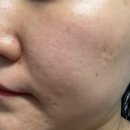 아이오더블유 | 트러블개선 크림 추천! 아이오투아 메디제이 더블유크림 라이트 80mL 사용 후기