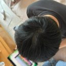 밸런스독B | 탈모약 추천