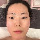 둔산로123번길 | 대전피부관리 끌리메 리얼후기 예신필수! 어깨 라인부터 팔자주름 리프팅까지