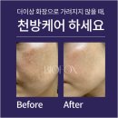 더샤인뷰티 | 피부 변화, 몸의 편안함, 은평통증관리를 동시에 잡는 더샤인뷰티 신사동 토탈케어 비밀