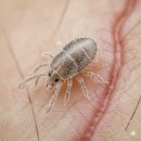 소망세탁소 | 아기 옴 증상 확진 과정: 소아과/피부과 오진 후, 우리가족은 옴 진드기와 전쟁 중