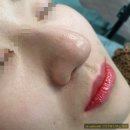 브로피시 이미지