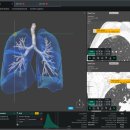 라인1차 이미지