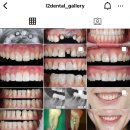 정도치과기공소 이미지