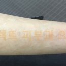 셀렉트피부과의원 네이버블로그