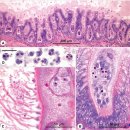 기수어 점박이송어 (Cynoscion species) 비뇨계 감염 점액포자충 Sinuolinea dimorpha 이미지