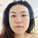 남양가운26 | 창원남양동여드름관리) 원장님의 쫀득한 손맛을 느껴요 “오브스킨”