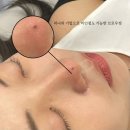 후후브로 이미지