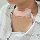 목말라배고파 | 용인세브란스 갑상선암 전절제 및 양측 림프절 곽청술 수술 후기 (이초록교수님)