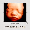 삼성1로 | 동탄제일병원 입체초음파 28주 AI얼굴 가격 후기