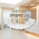 다정한이치과의원 | 인비절라인 통증 후기 걱정돼서 안 아픈 교정 방법 찾는다면