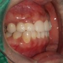 세련치과기공소 이미지