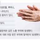 자가면역질환 뜻 증상 종류 원인 백반증 갑상선염 이미지