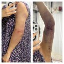 양이양 멍이군 | 365mc 교대점, 팔뚝 무한람스 [ 당일 ~ 2일차 ] 자세한 후기 ⌯◕ᴗ<⌯ಣ (추천인 코드O)
