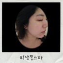 (주)몽스파 | 장위동피부관리 피생몽스파 LDM물방울관리