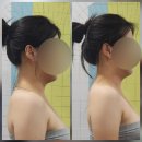 더볼륨뷰티샵 | 대구 상인동 '더스킨뷰티샵' 두개골비대칭교정 후기✨️ (전/후 사진 o)