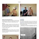 ＜나눔자료-2013-05-23＞목디스크와 협심증인줄알았더니... 흉곽출구증후군(TOS)인 환자(회원)가 많다는 사실..!!!| 이미지