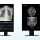 아이메드 이미지