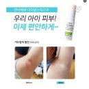 우리아이 모기 물렸을때 가려운 증상 완화 &#34;엔비베베 더마 밤 스틱&#34;(제품후기)