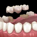 원스탑치과의원 이미지