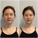 오직얼굴연구소 | 청담작은얼굴 관리 오직얼굴연구소 체험후기