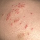 호스텔 다현 | 호주 워홀 • #4 왜 자꾸 다치고 아프고... | 시드니 호스텔 비추 | 스투시 시드니 | 시드니 GP 병원...