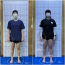 HNP | [허리디스크 통증] 재발된 무릎 십자인대 후유증? '보상패턴' 교정 후 10km 달리기 성공 비결