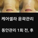케어셀라뷰티샵