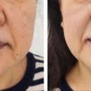 라하 헤어 이미지